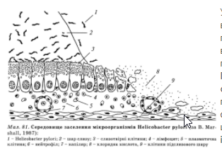 Морфологічною особливістю рН-асоційованого ХГ є наявність у сли­зовій оболонці шлунка мікроорганізмів