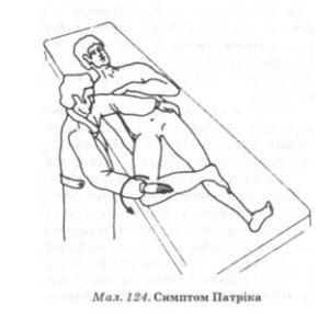 У разі запального процесу в крижово-клубовому з'єднанні хворий відчуває сильний біль; помірний біль, що посилюється під час звільнення хворим ноги