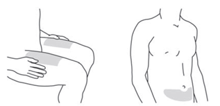 Если инъекцию проводит ваш помощник, можно использовать наружную поверхность верхней части плеча.
